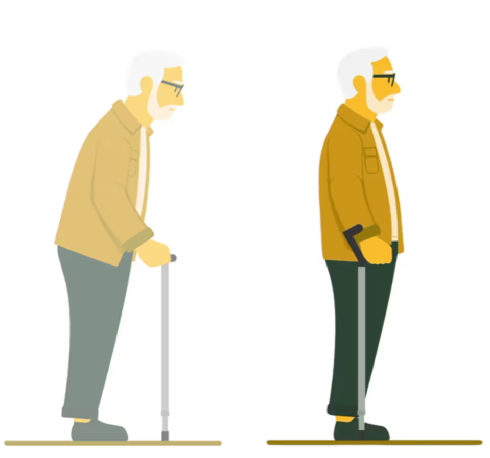 Side-by-side illustration comparing a man hunched over a traditional cane with the same man standing upright using the Y-Cane
