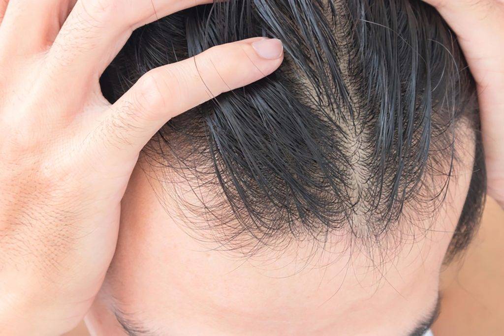 5 Root Causes of Hair Thinning and What To Do About It – DS Healthcare Group