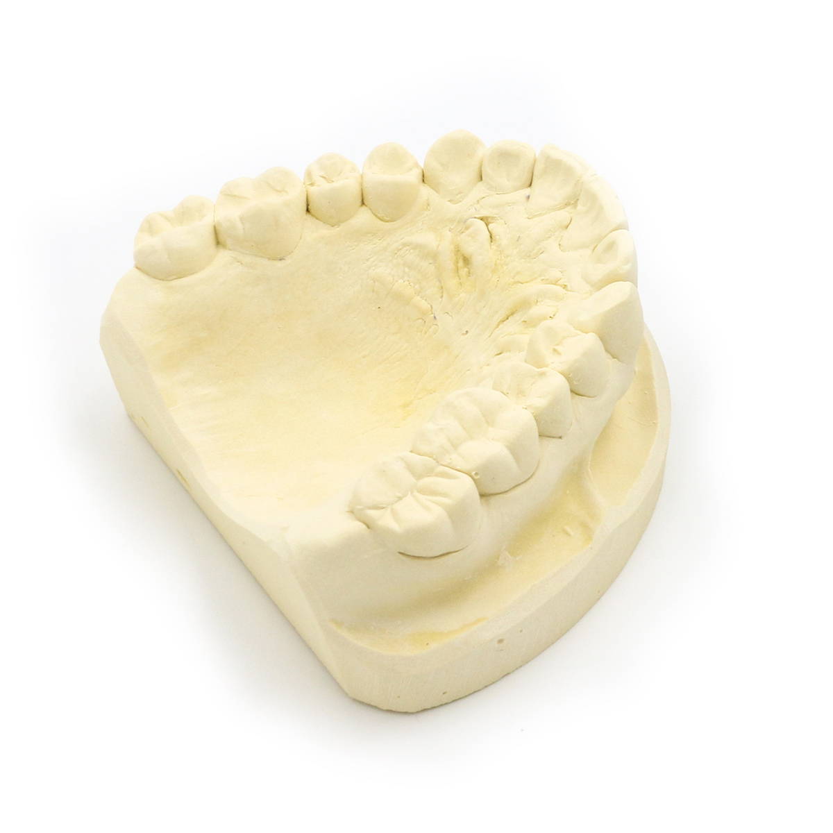 Dental Crowns & Bridges Clay & Associates DDS, PLC, Teeth Mold 