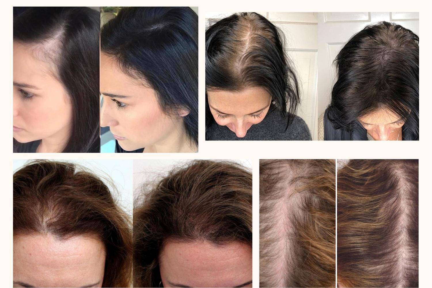 Mayraki_hair_growth_before_after1