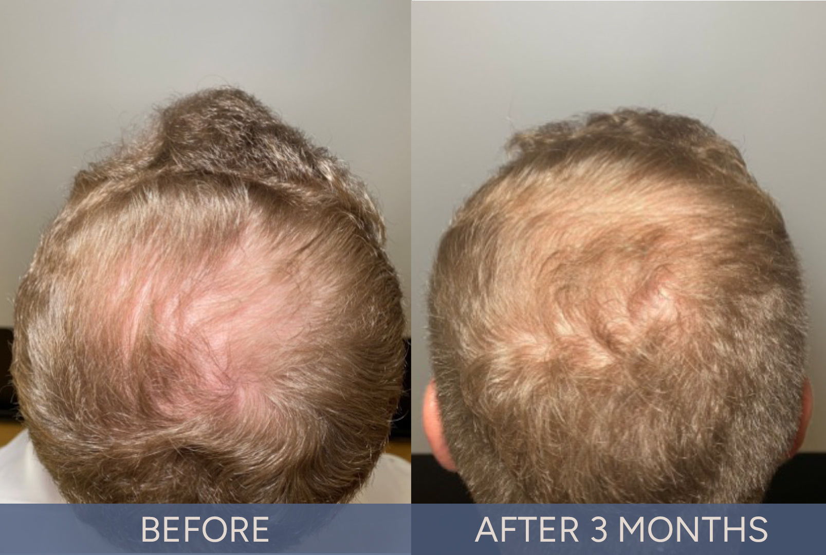 DeriveMD Before & After Results