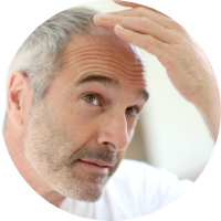 man looking in mirror wondering how much hair loss is normal