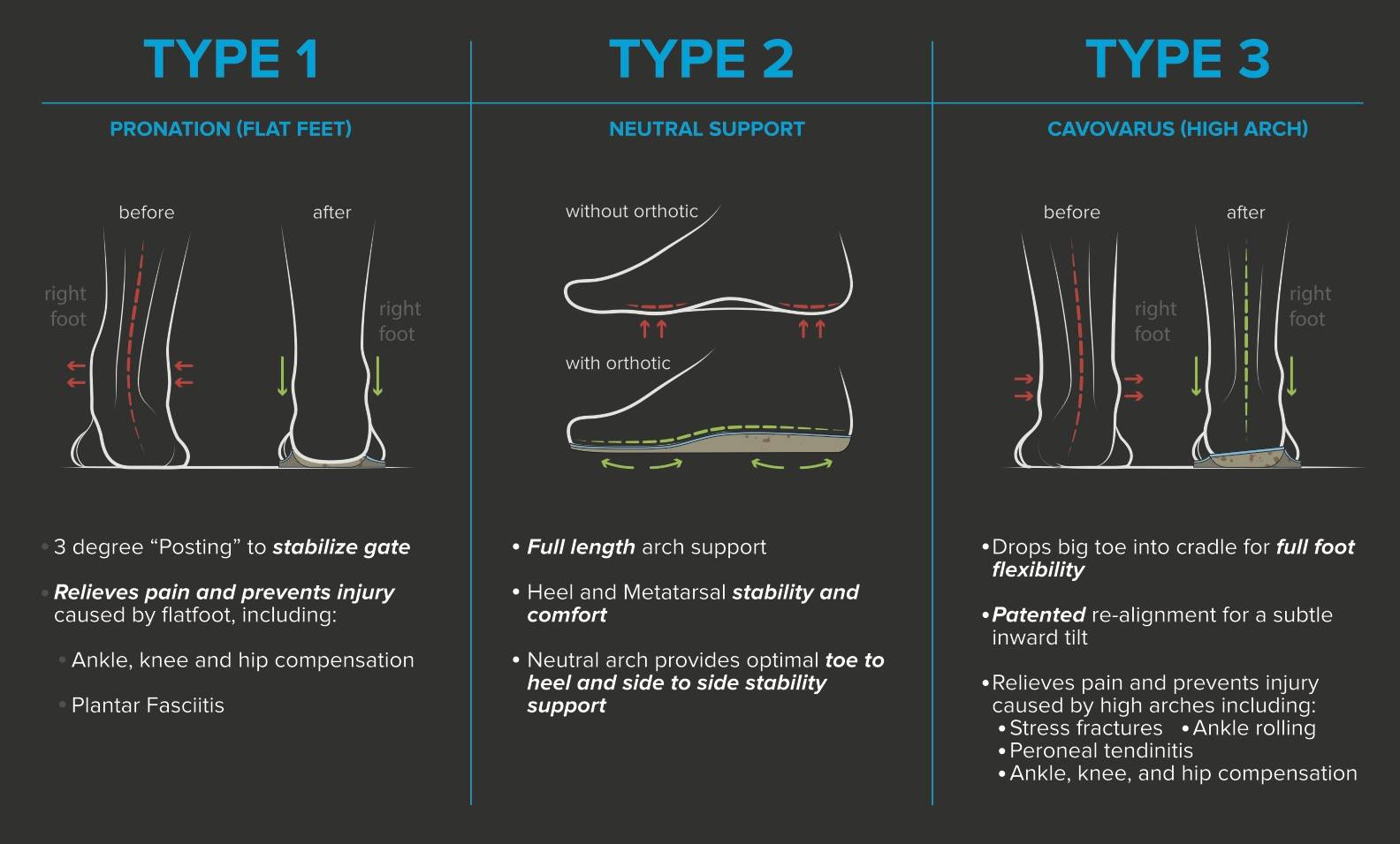 high arch supination
