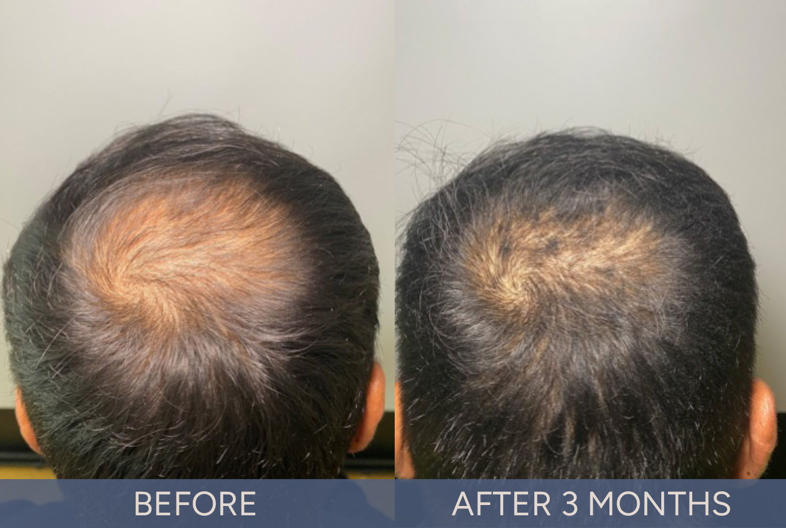 DeriveMD Before & After Results