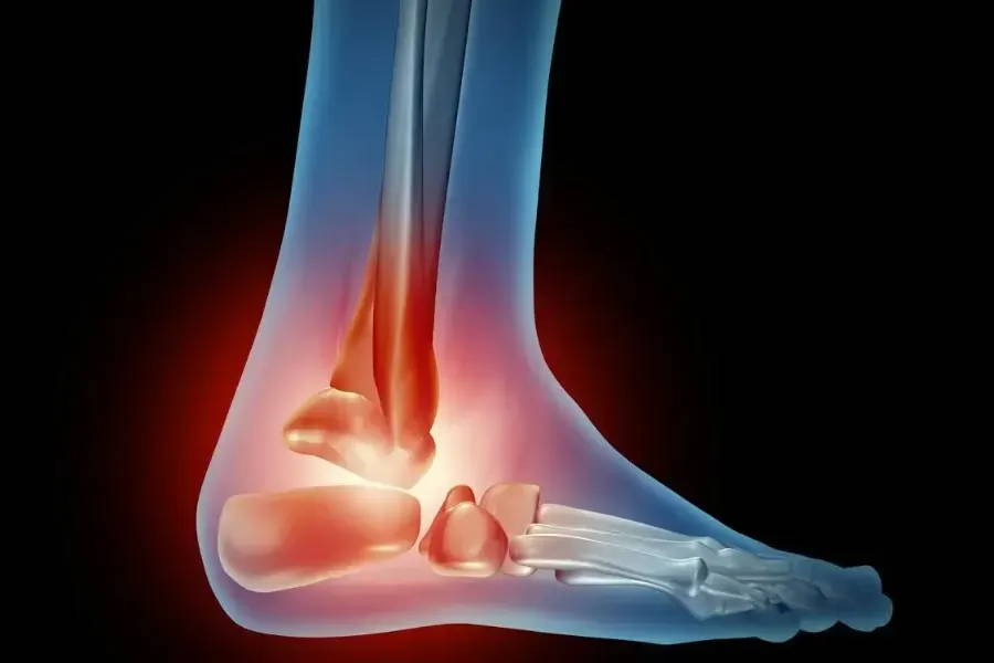 heel and joint pain