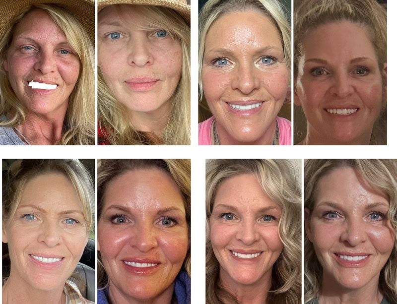 A collage of women's portraits showing varying expressions and appearances.