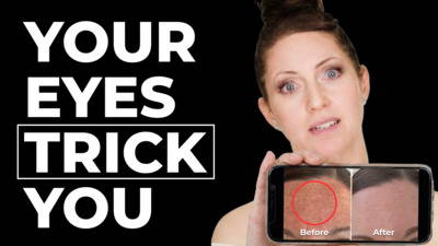 Why Dark Spots Look Worse Before They Get Better