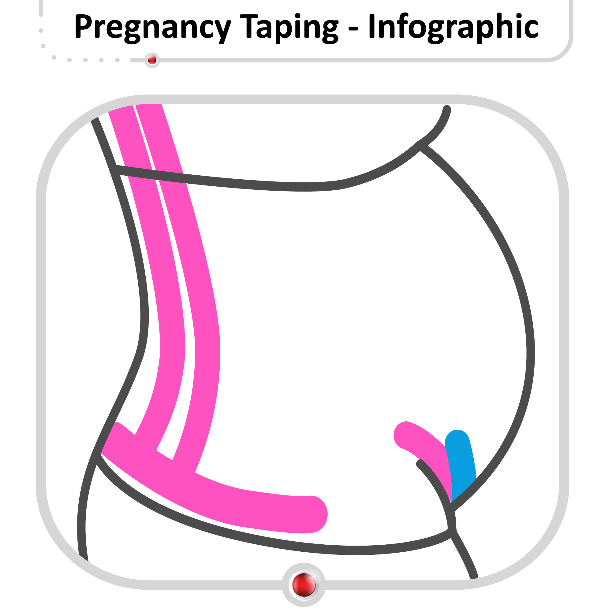 Pregnancy Taping – Kinesiology Sports Tape