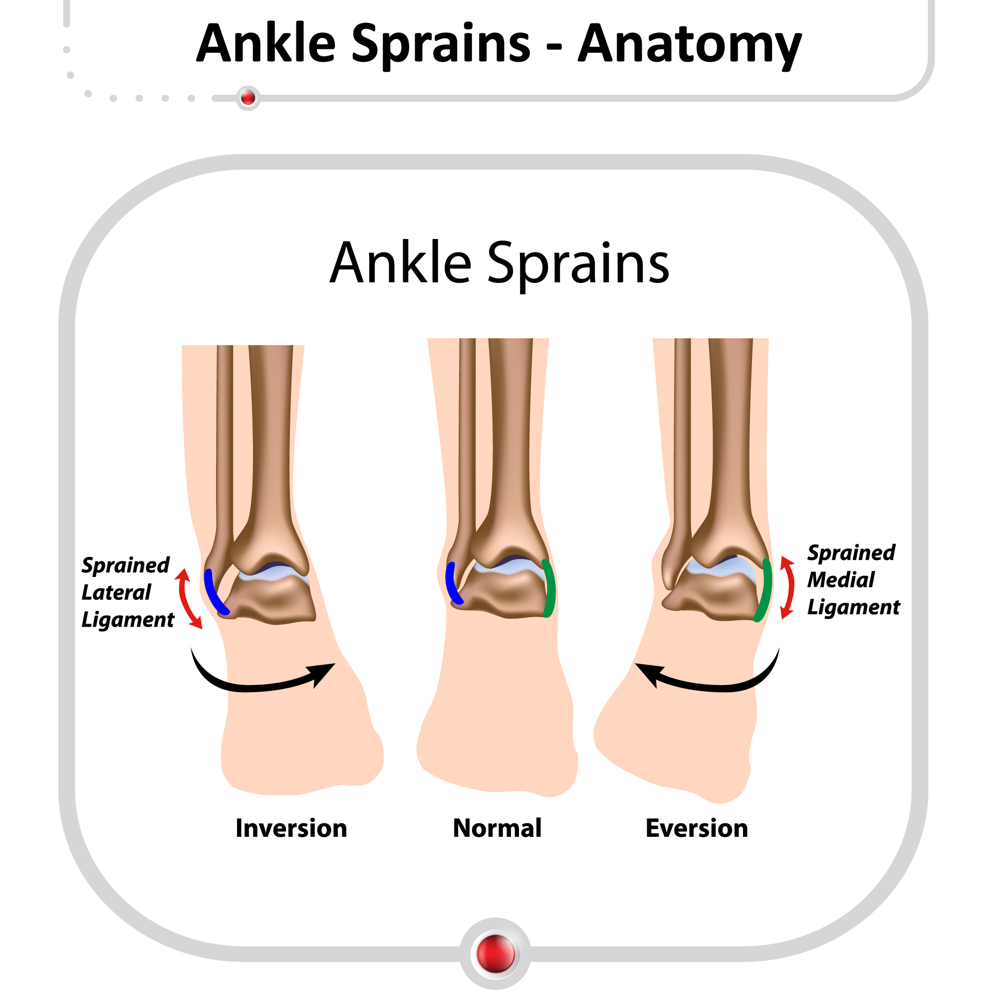 Touhou Bryggeri storhedsvanvid Ankle Pain – Kinesiology Sports Tape