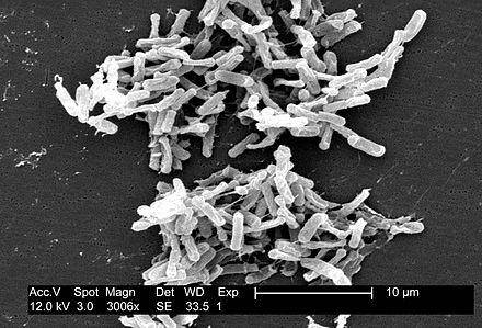 Scan of Clostridium difficile bacteria