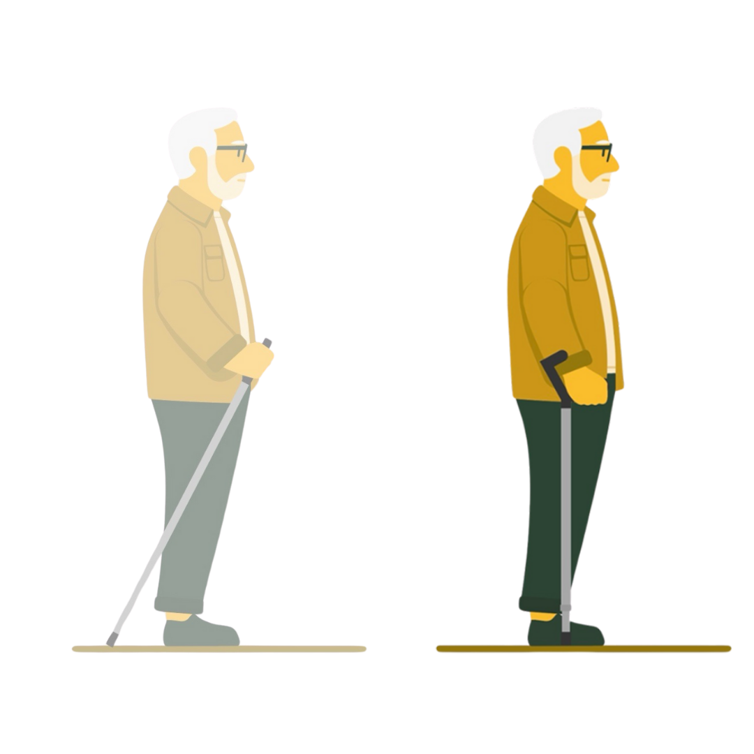 Side-by-side illustration comparing an older man using a trekking pole on the left with the same man using the Y-Cane on the right. The trekking poles are angled backwards and Y-Cane is in-line with the leg.