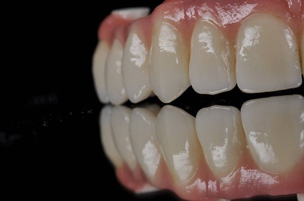 précision ackuretta imprimante 3D