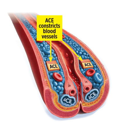 Illustration of blood vessels showing ACE's role in constricting them.