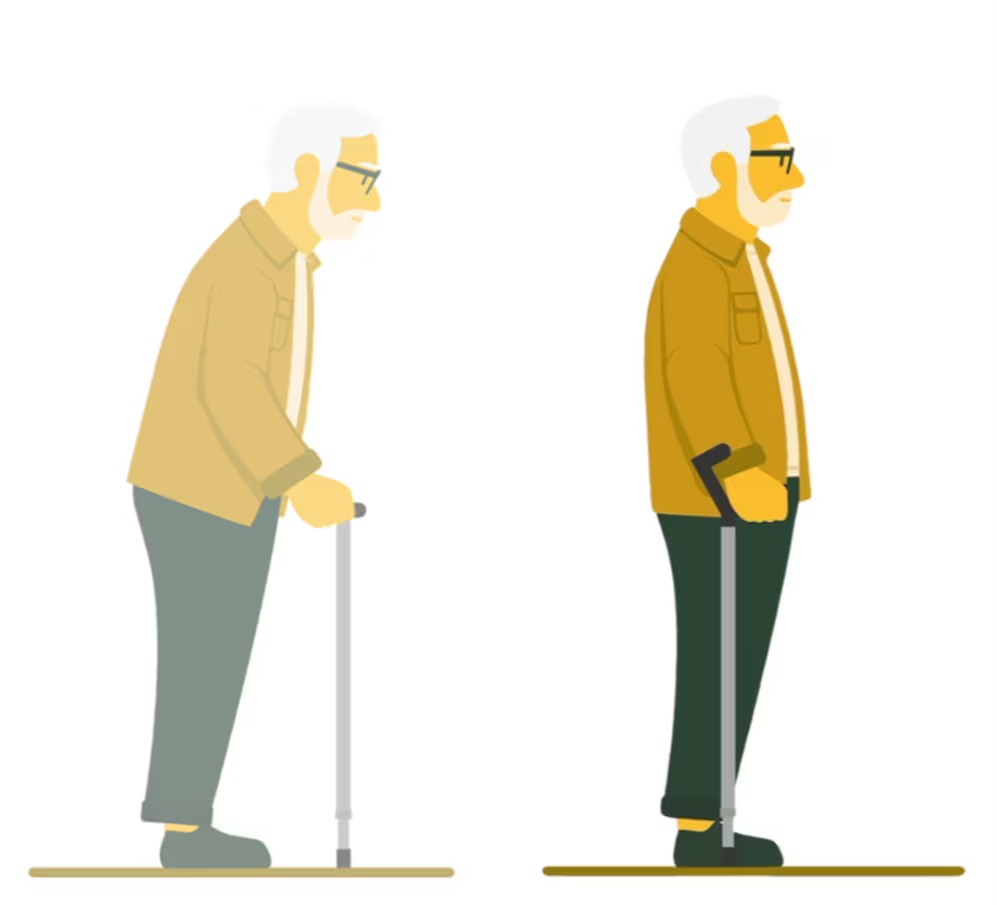 Side-by-side illustration comparing an older man hunched over a traditional cane on the left with the same man standing upright using the Y-Cane on the right