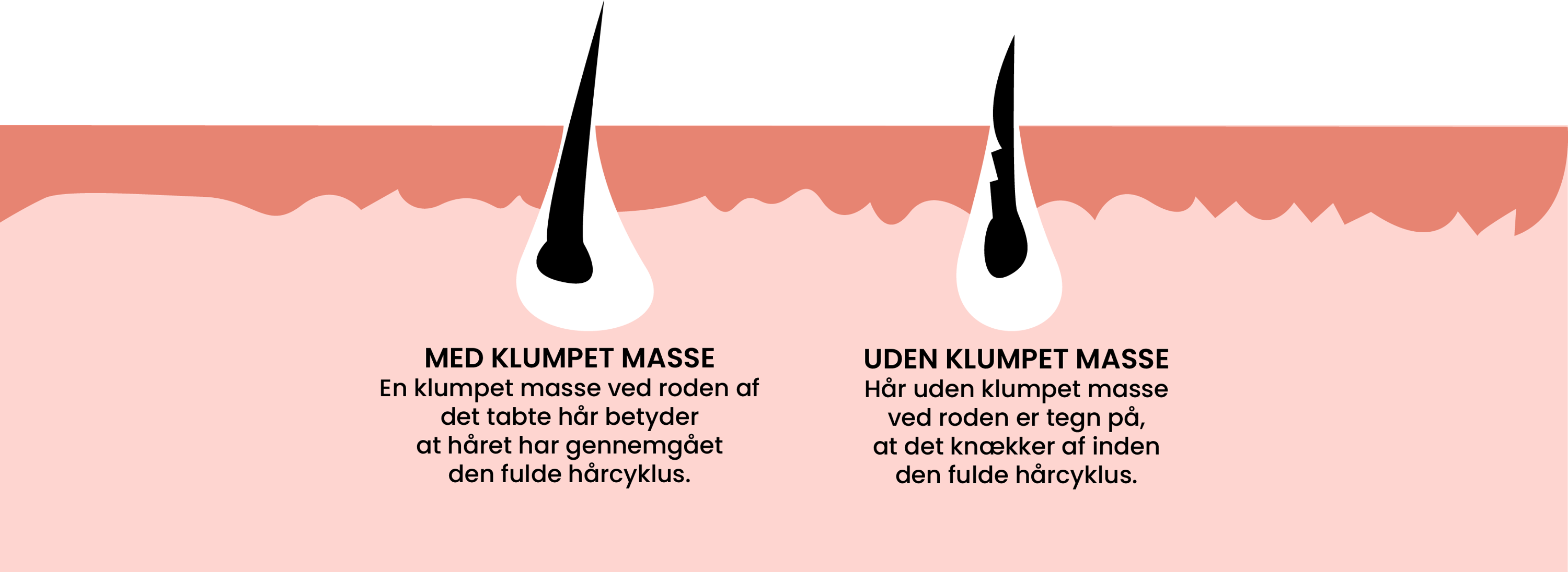 Guide: Fælder du meget hår? Sådan stopper du med at fælde.