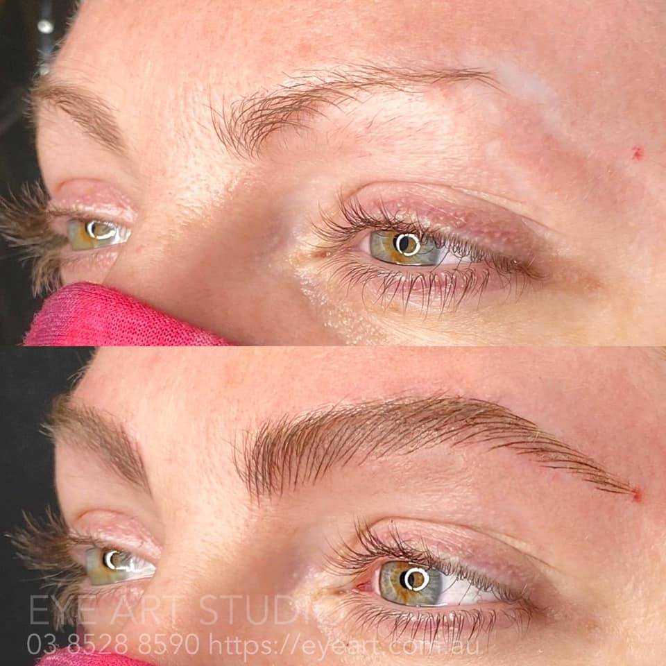 Microblading