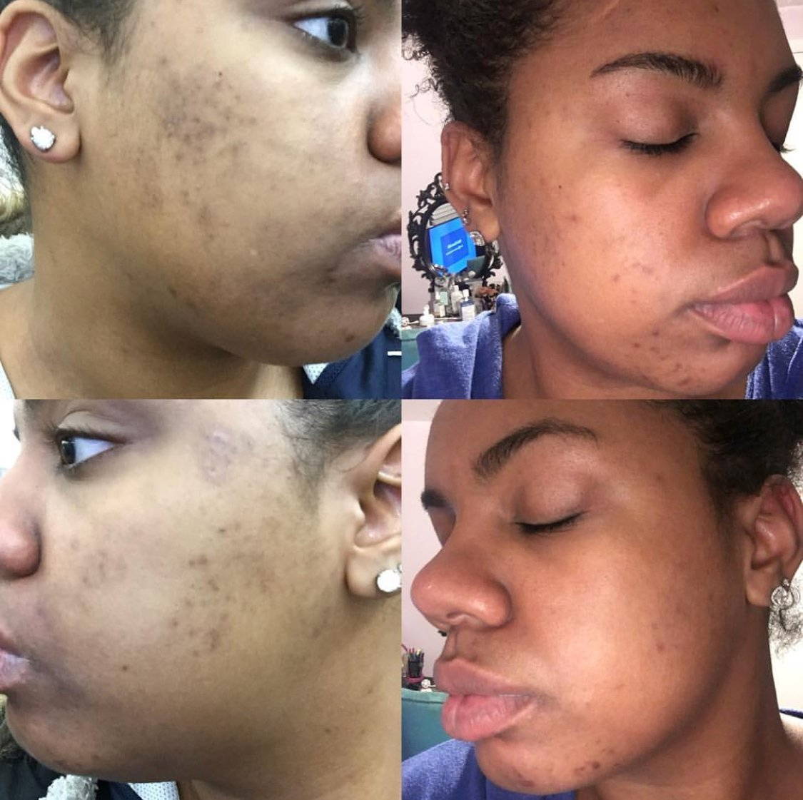 admire my skin serum