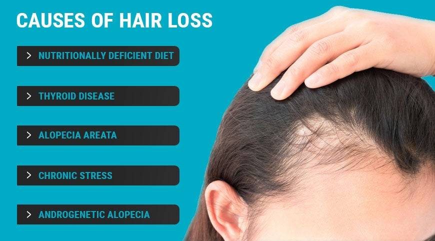 Hair Loss Treatments, Causes & Signs – Capillus