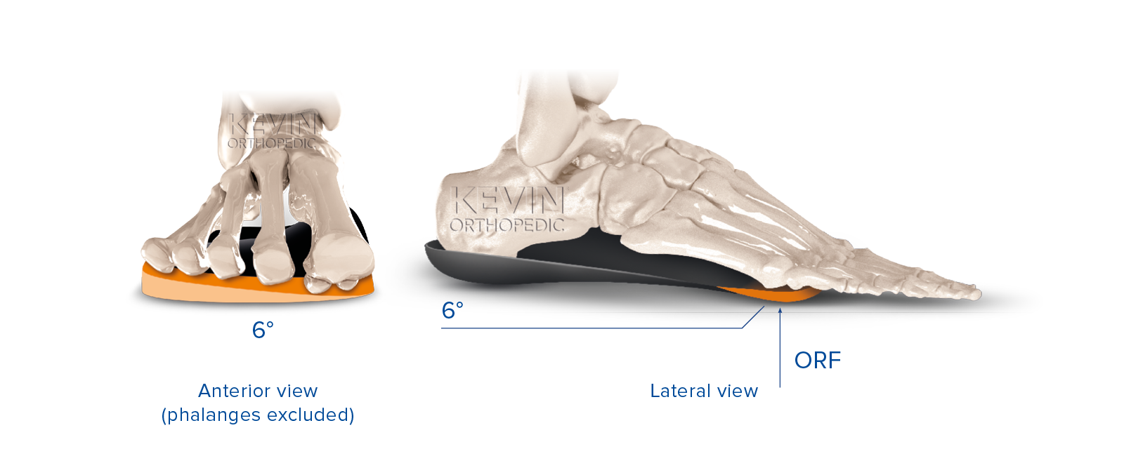 THE CLINIC GUIDE: SUPINATION - Valgus Metatarsal Wedge – Kevin ...