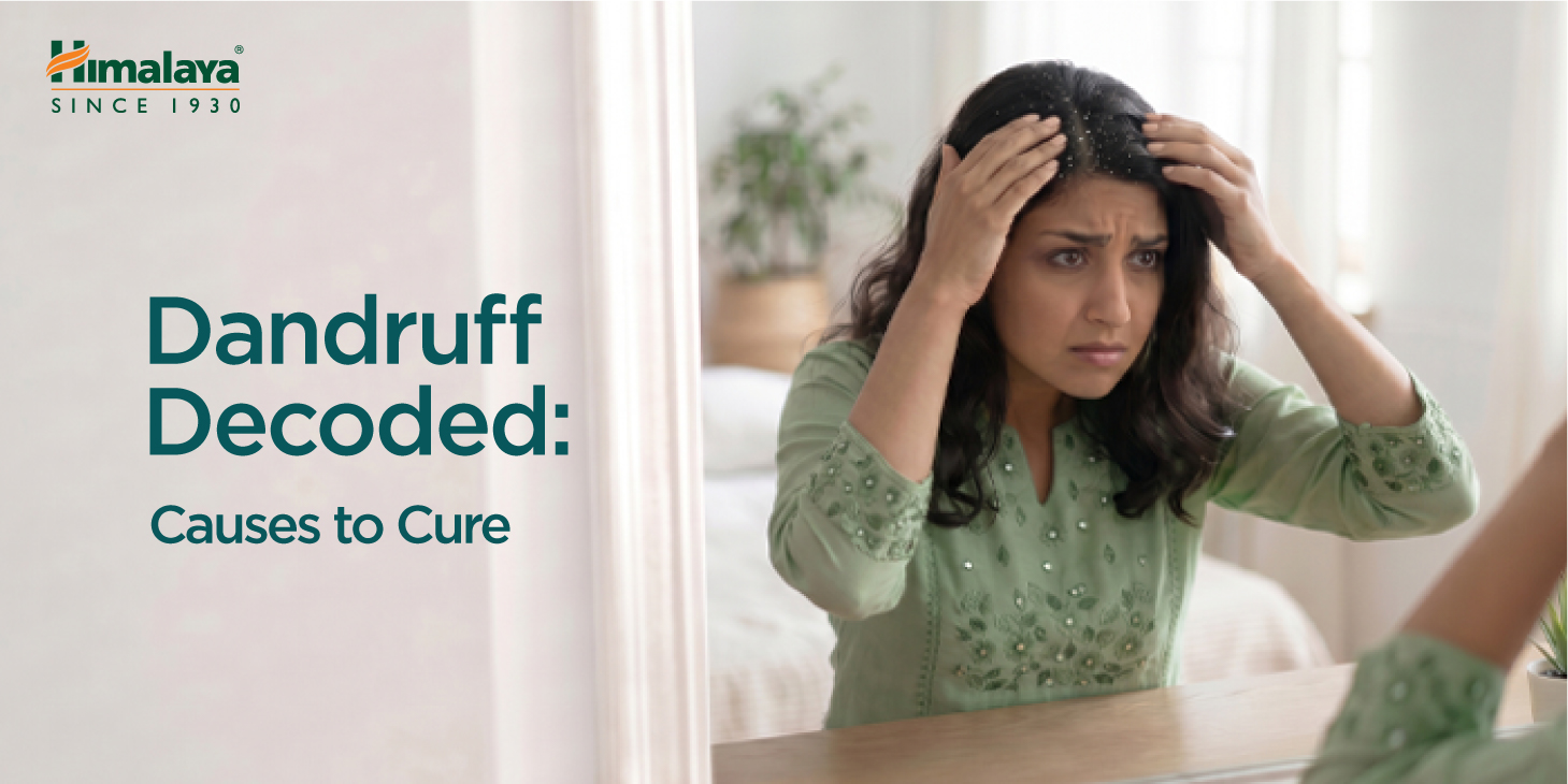 What Causes Dandruff? Symptoms, Prevention & Herbal Treatments