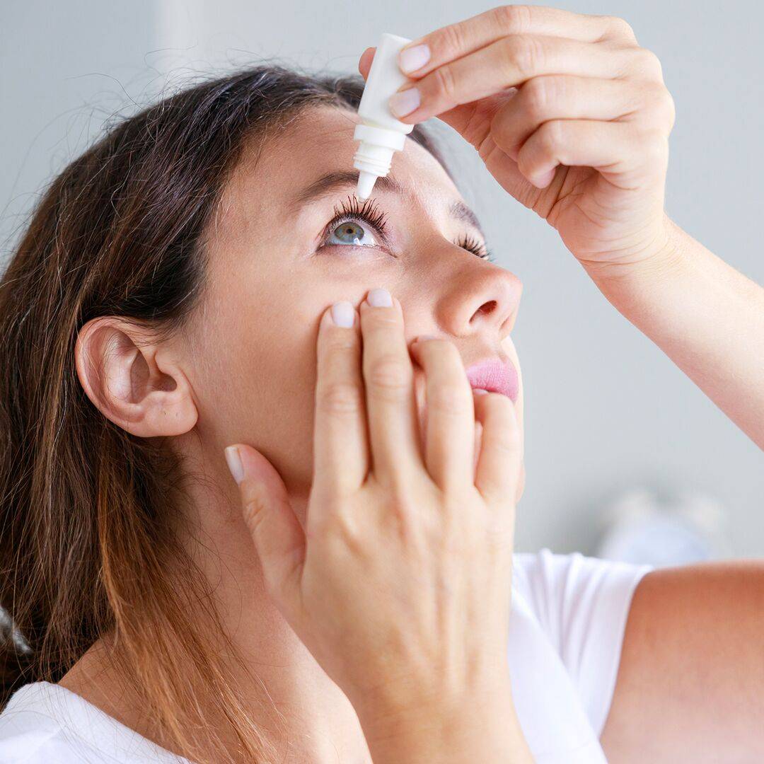  Žena si pozerajúc dohora kvapká očné kvapky na zmiernenie príznakov alergie, ktoré pravdepodobne spôsobuje poletujúci peľ, roztoče domáceho prachu alebo alergény domácich zvierat