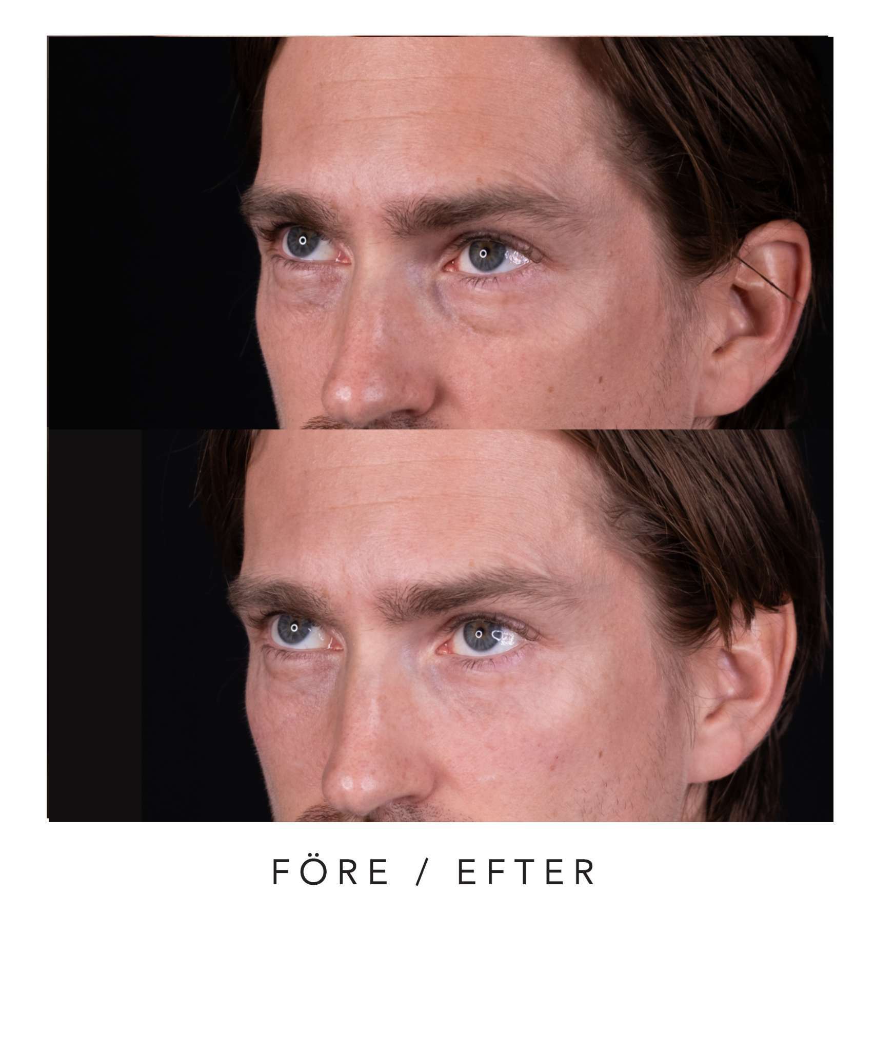 Before and after images of a person's face.