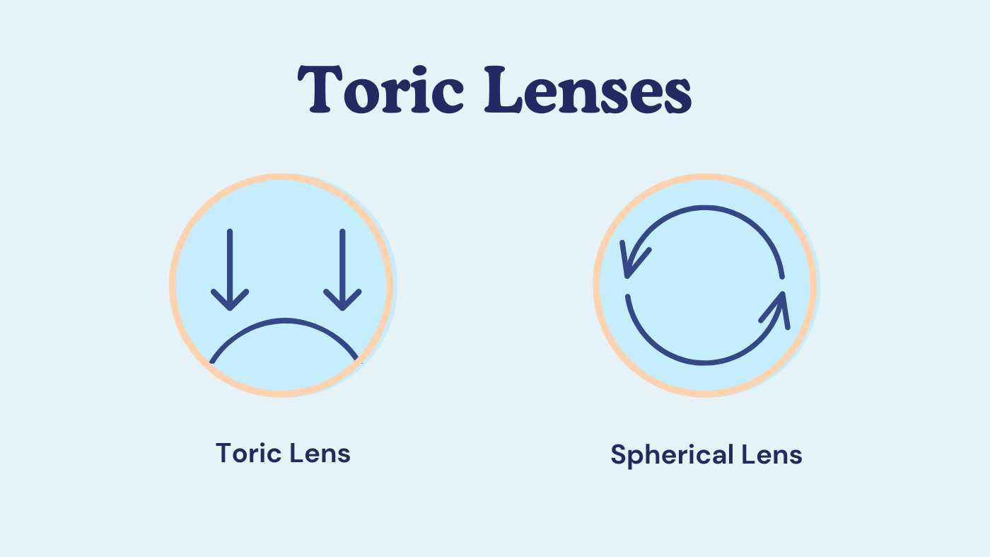 What are Toric Contact Lenses?