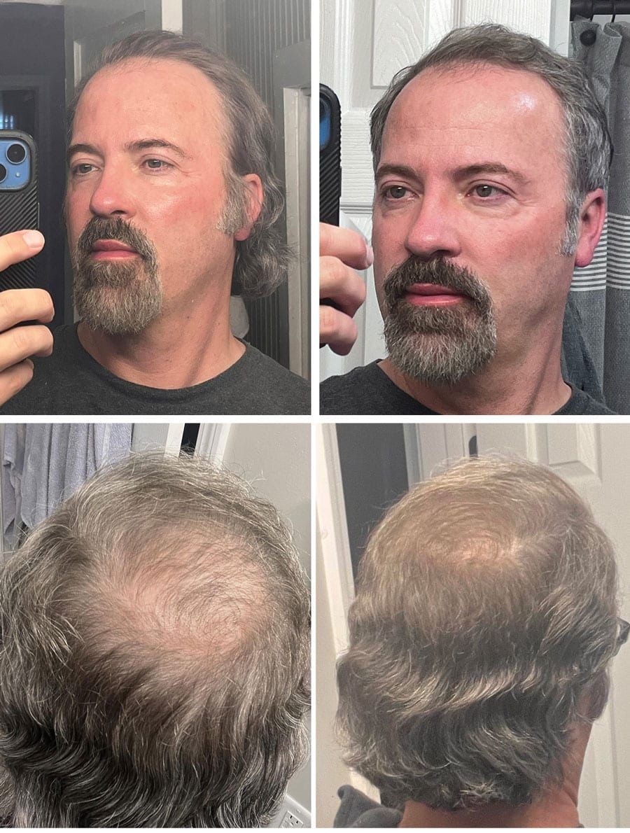 Man taking selfies showing different angles of his hair.