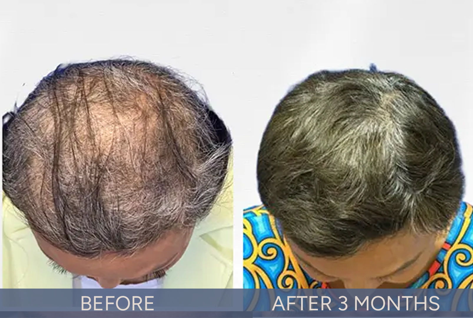DeriveMD Before & After Results