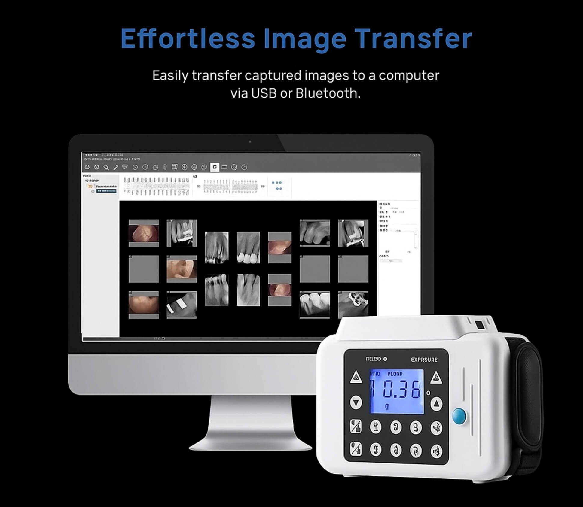 USA Stock Portable Dental X-Ray Unit With Screen + Size 1.0 Sensor – 60kV, CMOS, RAY-121