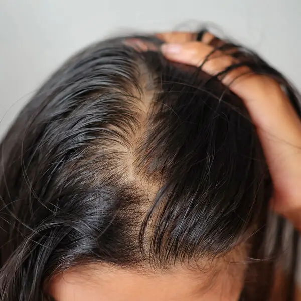 This shampoo and conditioner duo creates the optimal conditions for hair success, setting the foundation for stronger, healthier hair.