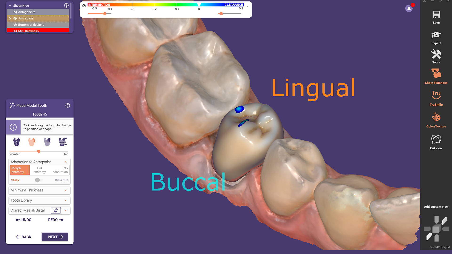 Dentalcad Rijeka exocad