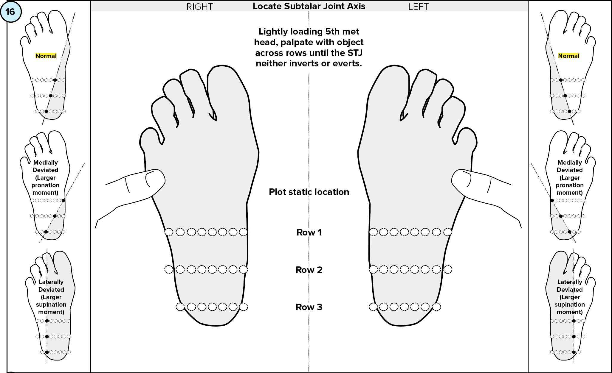 Locating Subtalar Joint Axis