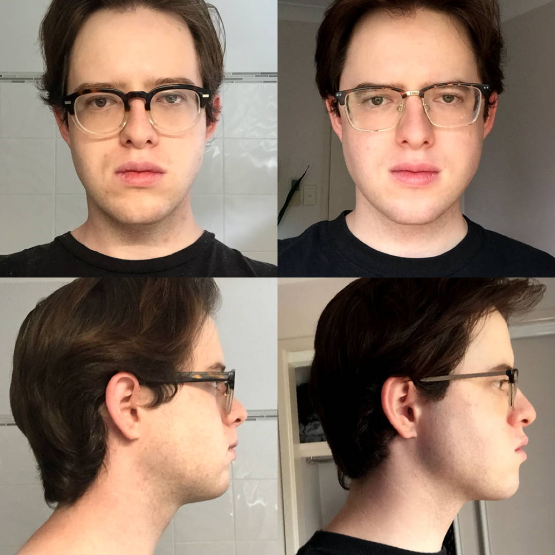 Does CHISELL jawline enhancer really work? We tested.