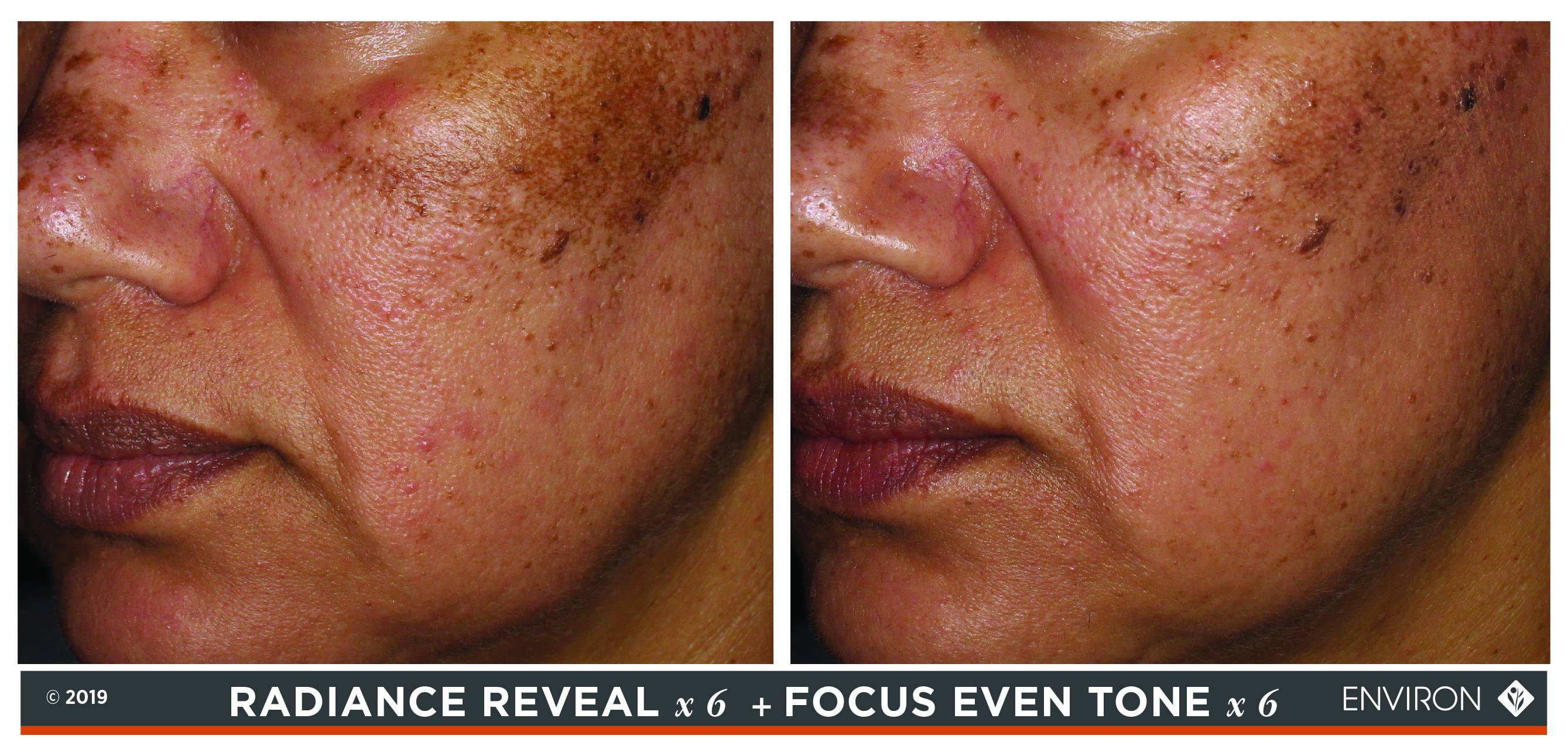 Best Facial Treatments For Your Skincare Routine Skin3 Salon Nw6 London