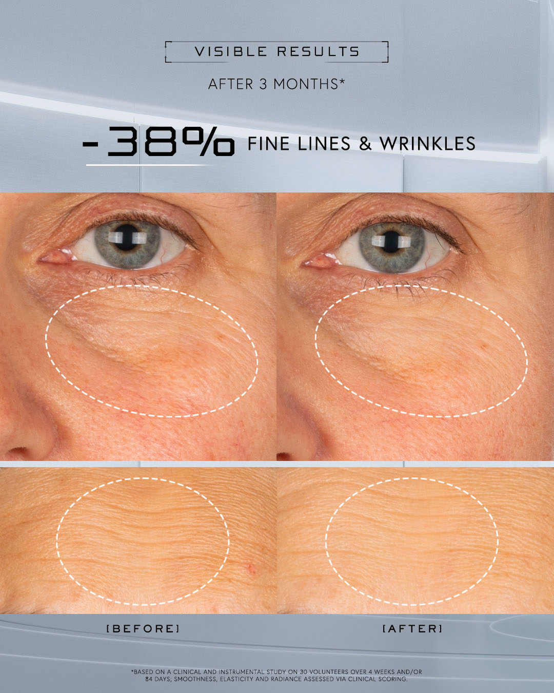 Before and after images showing reduction in fine lines and wrinkles.