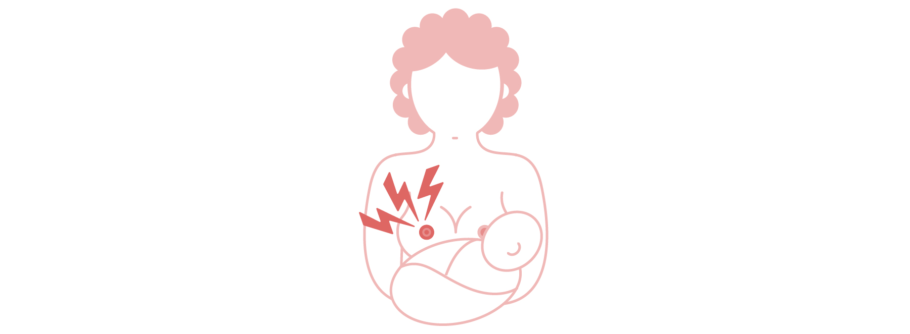 Thrush on Nipples: Symptoms, Treatment, and Breastfeeding