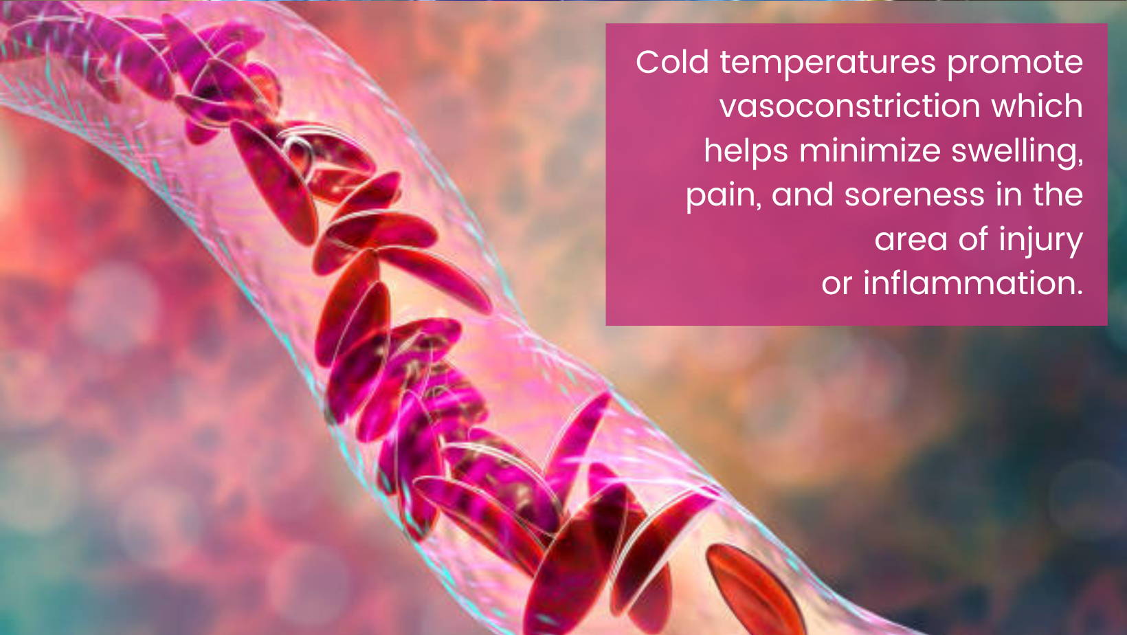 Cold temperatures promote vasoconstriction which helps minimize swelling, pain, and soreness in the area of injury or inflammation.