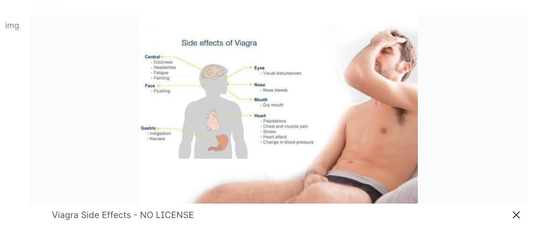 Viagra Side Effects - NO LICENSE
