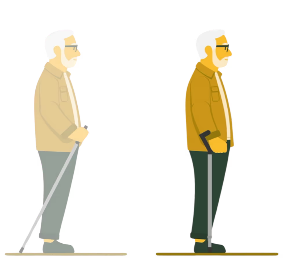 Side-by-side illustration comparing an older man using a trekking pole on the left with the same man using the Y-Cane on the right. The trekking poles are angled backwards while the Y-Cane is in-line with the leg.