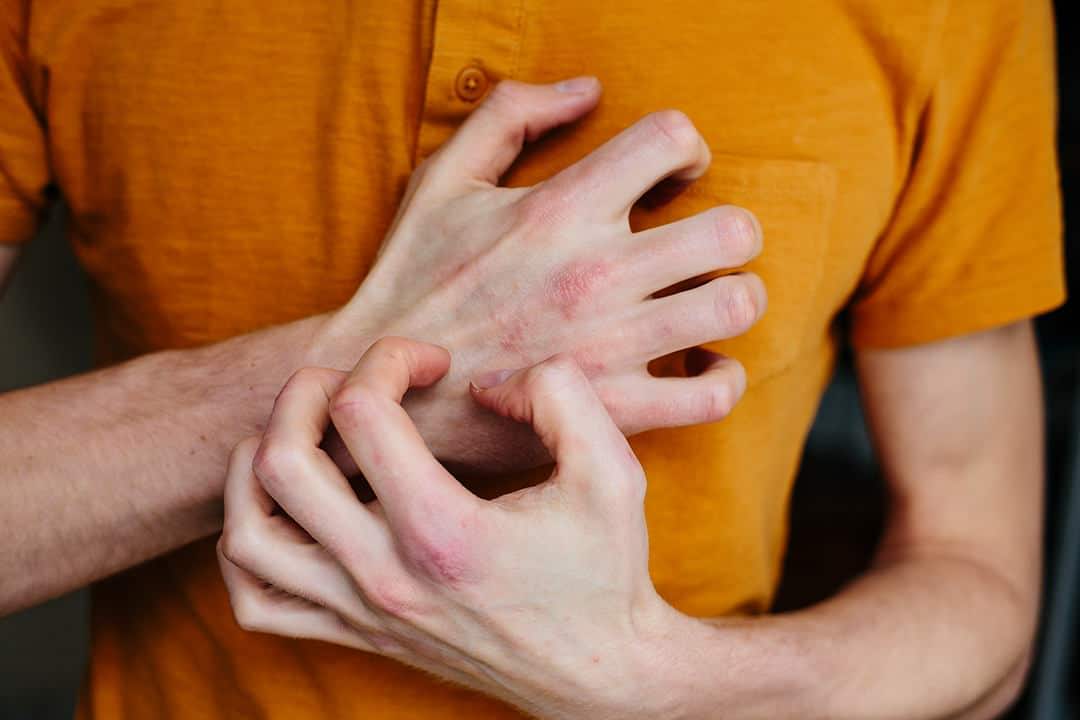 This is a picture of a man scratching his hand.