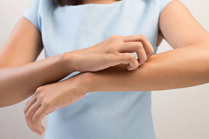 L'immagine di una donna che si gratta il braccio