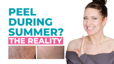 The Truth about Remodeling Scars and Peeling in the Summer