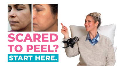 Why Mandelic is the Best First Peel if You’re Terrified of Acids