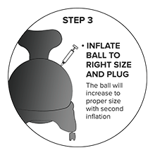 step 3: inflate the ball to the right size and plug