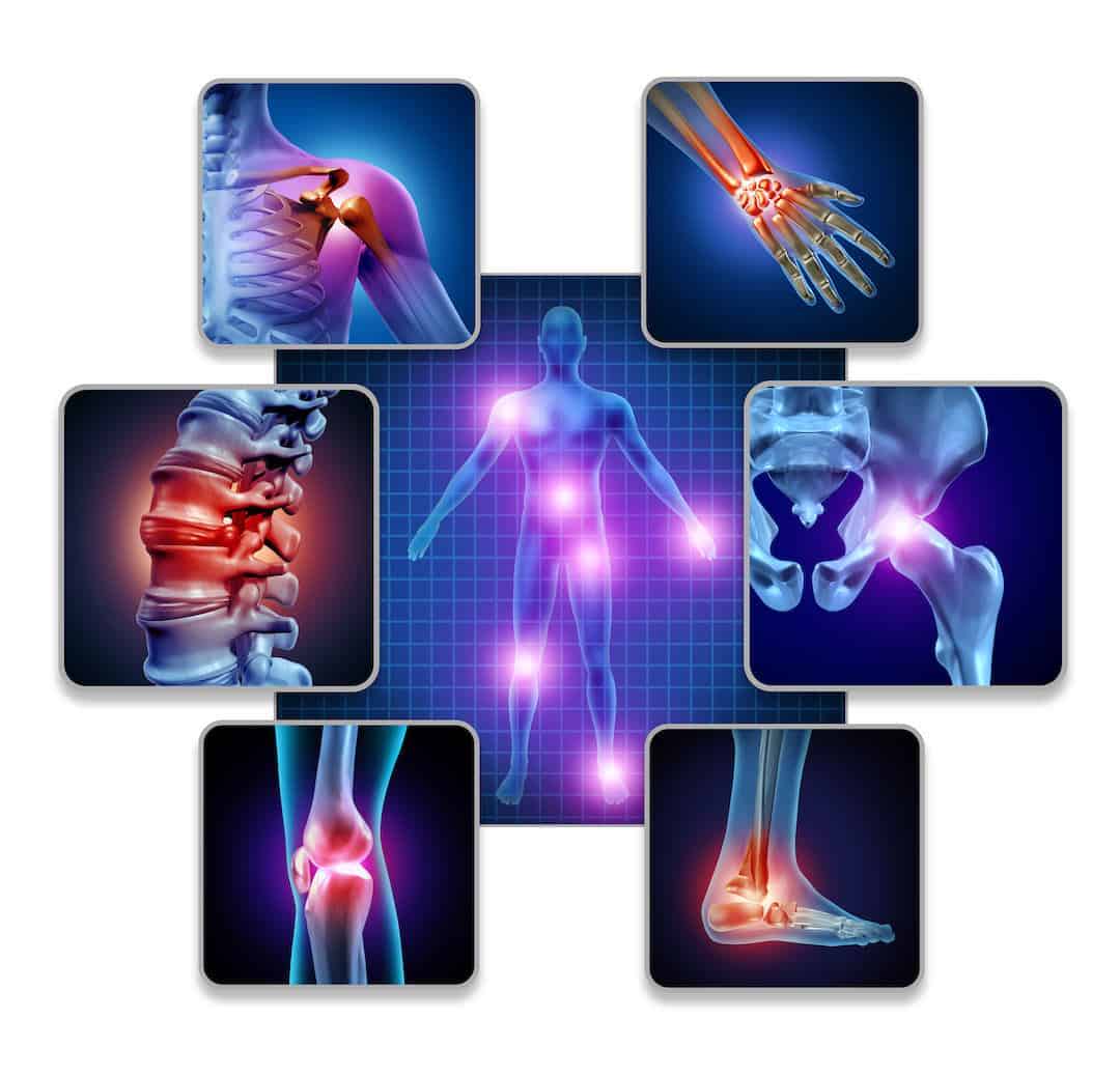 This is a picture graphic of various forms of joint pain.