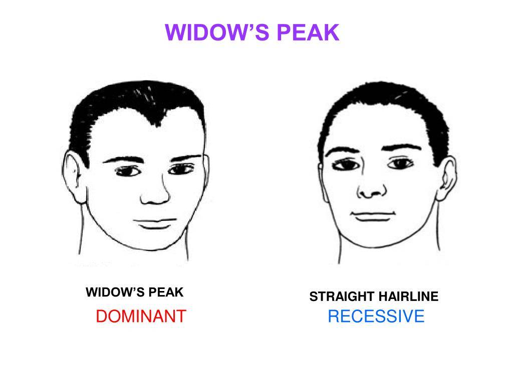 Why Do I Have a Widow's Peak Hairline? – DS Healthcare Group