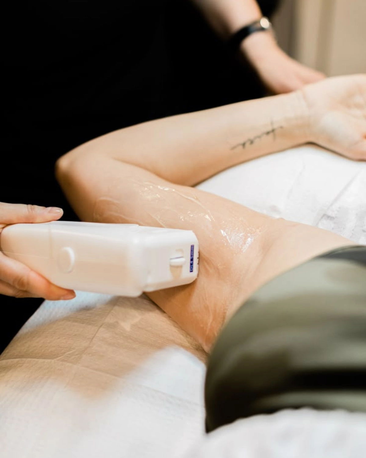 laser Hair Removal at prolase