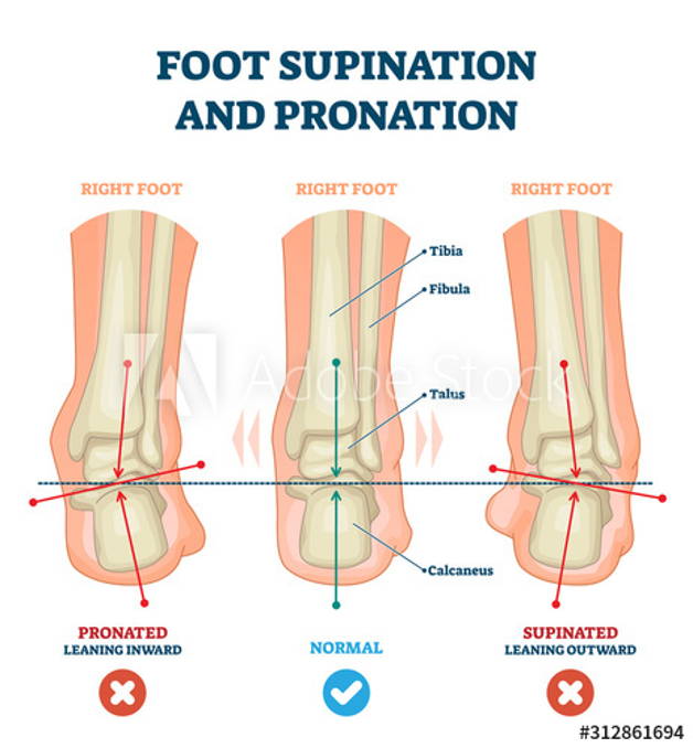 shoes for supination and high arches
