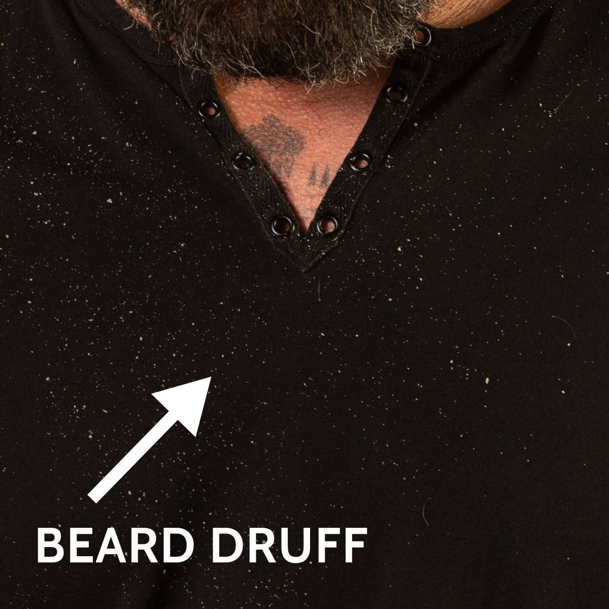 Beard Druff